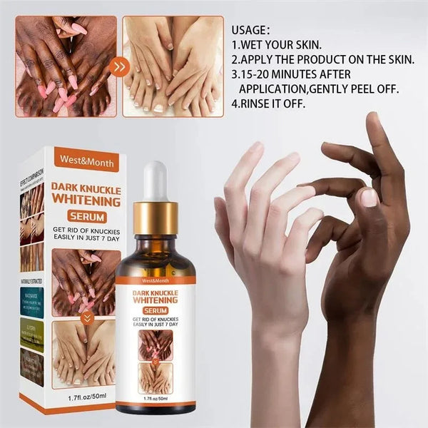 Dark Knuckles Whitening Serum Remover Get Rid of Dark Knees Dark Knuckle Elbow Cream Moisturizing Brighten Skin Tone Care - SHOPPING YARD