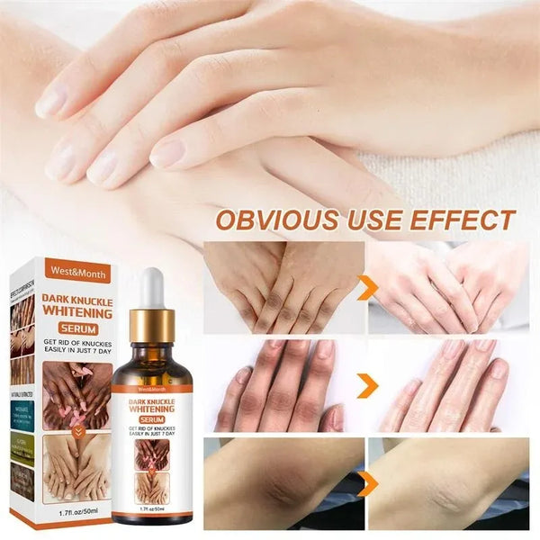 Dark Knuckles Whitening Serum Remover Get Rid of Dark Knees Dark Knuckle Elbow Cream Moisturizing Brighten Skin Tone Care - SHOPPING YARD
